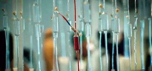 已完成动物实验和临床前研究,“光谷造”人工血管3月开始临床试验